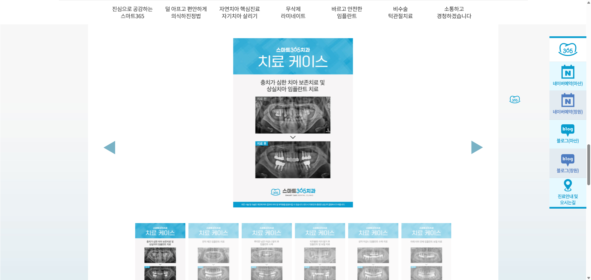 smart365dental.com_ (4)