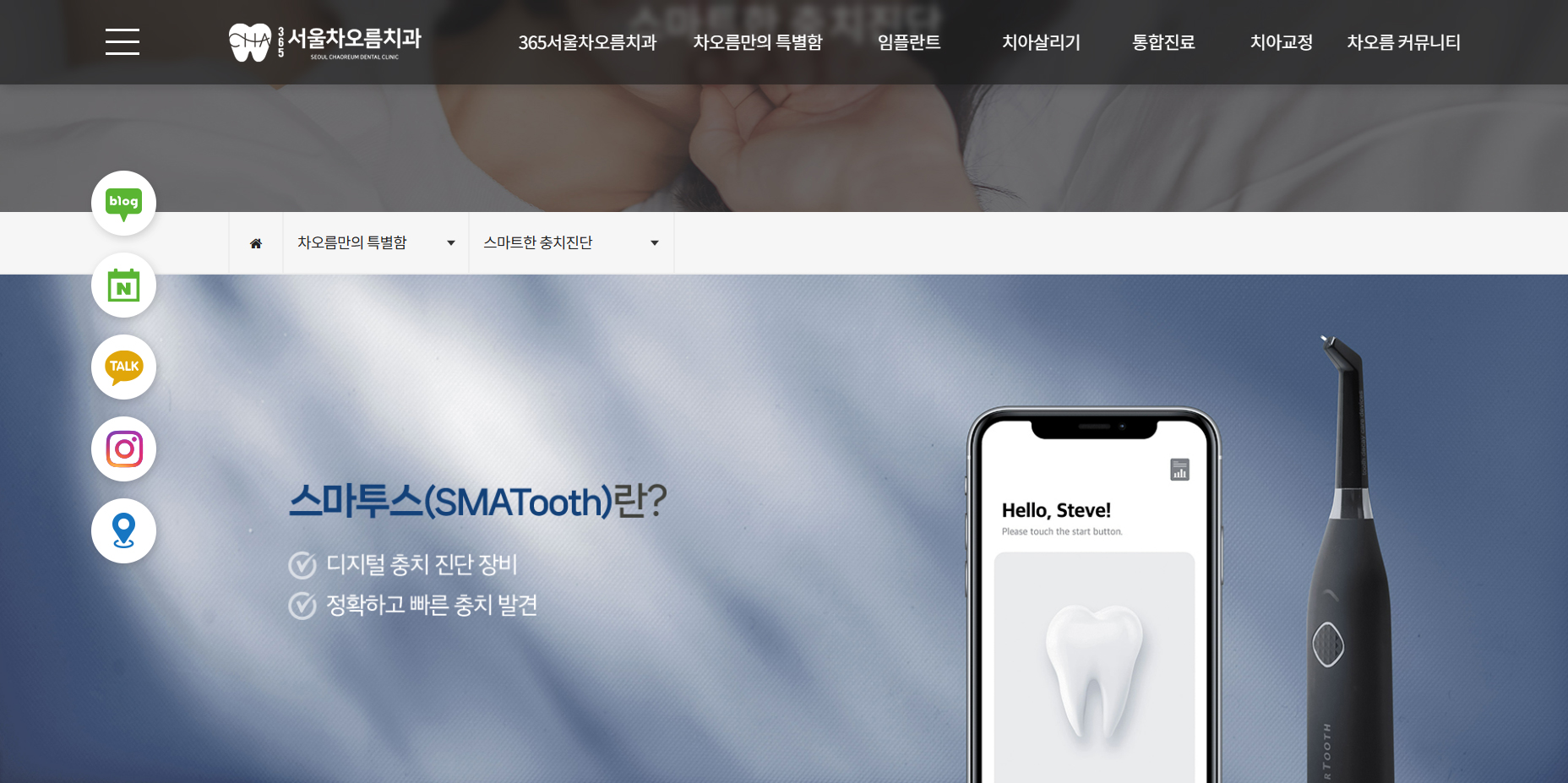 365서울차오름치과 - 스마트한 충치진단